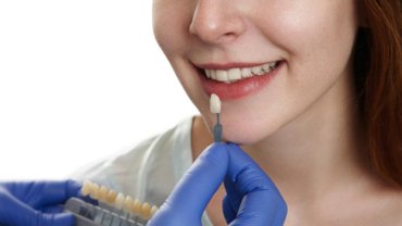 From Ordinary to Extraordinary Dentist: Find the Perfect Veneers in Spring, TX